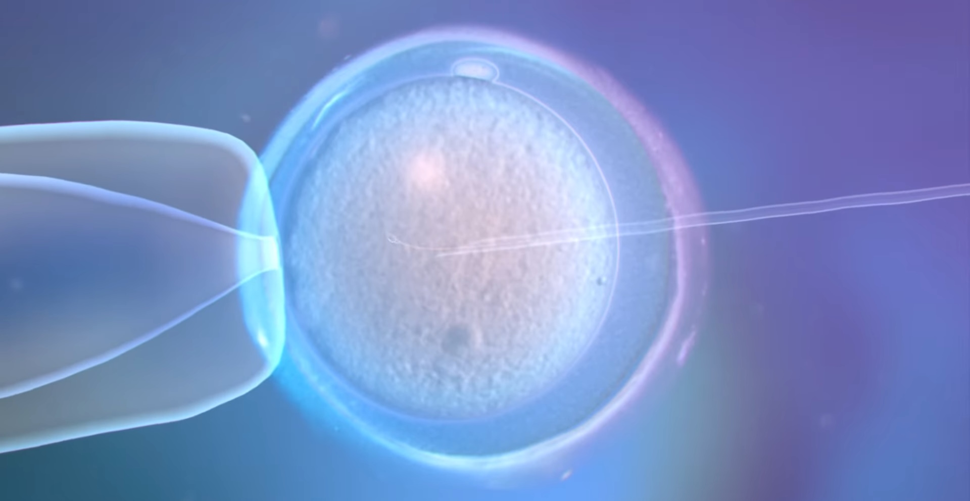 La fecundación in vitro involucra la fertilización de óvulos fuera del cuerpo de la mujer, en un laboratorio, y luego la transferencia de los embriones resultantes al útero de la mujer para el desarrollo y el embarazo. La FIV es una de las técnicas más comunes dentro de las tecnologías de reproducción asistida (TRA) y ha permitido que muchas parejas infértiles cumplan su sueño de ser padres.