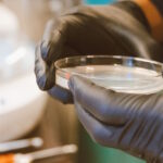 Uso del agar como soporte en los cultivos en placas de laboratorio